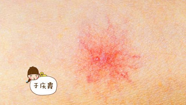 出現(xiàn)下列癥狀 快去給肝臟做個檢查_出現(xiàn)下列癥狀 快去給肝臟做個檢查_出現(xiàn)下列癥狀 快去給肝臟做個檢查