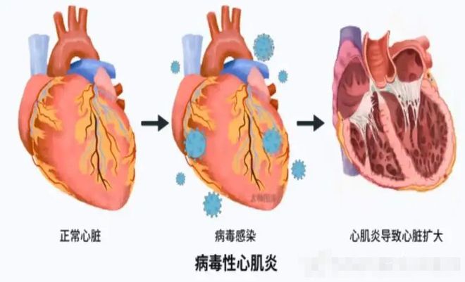 2024第二波疫情已經到來_疫情2024年_疫情到來的時間是多少